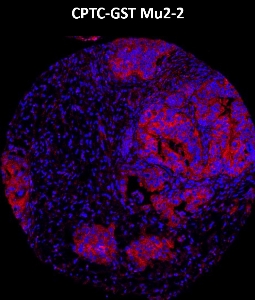 Click to enlarge image Imaging mass cytometry on lung cancer tissue core using CPTC-GSTMu2-2 metal-labeled antibody.  Data shows an overlay of the target protein signal (red) and DNA (blue). Dilution: 1:100 of 0.5mg/mL stock. Signal was also obtained in other normal tissues (testis, liver, colon, endometrium, appendix, bone marrow, breast, kidney, lung, and placenta) and cancer tissues (breast, colon, prostate, lung, and ovarian).