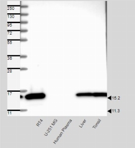 Click to enlarge image Results provided by the Human Protein Atlas (www.proteinatlas.org).  Single band corresponding to the predicted size in kDa (+/-20%). Analysis performed using a standard panel of samples. Antibody dilution: 1:250.