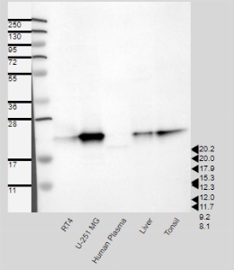 Click to enlarge image Results provided by the Human Protein Atlas (www.proteinatlas.org). Single band corresponding to the predicted size in kDa (+/-20%). Analysis performed using a standard panel of samples. Antibody dilution: 1:250.