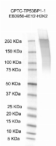 Click to enlarge image Western Blot using CPTC-TP53BP1-1 as primary antibody against recombinant human tumor protein p53 binding protein 1 (TP53BP1), transcript variant 3
protein (lane 2). Also included are molecular weight standards (lane 1).