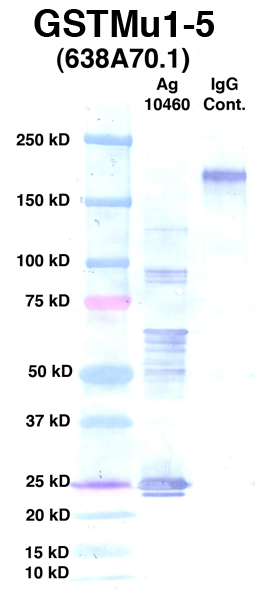 Click to enlarge image Western Blot using CPTC-GSTMu1-5 as primary Ab against Ag 10460 (lane 2). Also included are molecular wt. standards (lane 1) and mouse IgG control (lane 3).