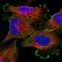 Click to enlarge image Results provided by the Human Protein Atlas (www.proteinatlas.org). The subcellular location is supported by literature. Immunofluorescent staining of human cell line U-251 MG shows localization to plasma membrane & cytosol. Human assay: U-251 MG fixed with PFA, dilution: 1:4.