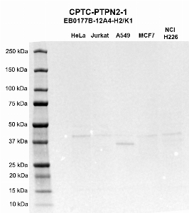 Click to enlarge image Western blot using CPTC-PTPN2-1 as primary antibody against HeLa (lane 2), Jurkat (lane 3), A549 (lane 4), MCF7 (lane 5), and NCI-H226 (lane 6) whole cell lysates.  Expected molecular weight - 48.5 kDa, 45.2 kDa, 41.0 kDa, and 48.0 kDa.  Molecular weight standards are also included (lane 1). All cell lines are positive.