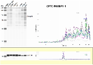 Click to enlarge image Western Blot using CPTC-PAXBP1-1 as primary antibody against human cell lysates CCRF-CEM, K-52, MOLT-, SR, Jurkat and mouse cell lysates CHI2.LX and EL4 (expected MW is about 105 KDa). The antibody CPTC-PAXBP1-1 does not recognize the endogenous protein in any of the tested lysates. Cell lines were also tested for GAPDH.