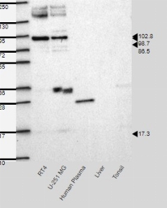 Click to enlarge image Results provided by the Human Protein Atlas (www.proteinatlas.org). Band of predicted size in kDa (+/-20%) with additional bands present. Analysis performed using a standard panel of samples. Antibody dilution: 1:500.