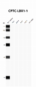 Click to enlarge image Automated Western Blot using CPTC-LBX1-1 as primary antibody against cell lysates A549, H226, HeLa, Jurkat and MCF7. Expected MW of 30.2 KDa. All cell lysates negative.  Molecular weight standards are also included (lane 1).