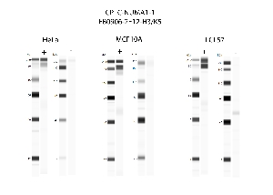 Click to enlarge image Automated western blot using CPTC-NUMA1-1 as primary antibody against cell lysates HeLa, MCF10A, and LCL57.  Samples from each cell line were irradiated with 10 Gy as shown in ‘+’ indicated lanes. Samples from each non-irradiated cell line were treated with alkaline phosphatase enzyme as shown in ‘-‘ indicated lanes.  Molecular weight standards are included for each cell line.