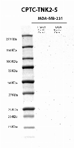 Click to enlarge image Western Blot usign CPTC-TNK2-5 as primary antibody against cell lysates of MDA-MB-231 cells treated (lane 2) and not treated (lane 3) with EGF (100 ng/mL0 for 10 minutes, after overnight starvation). Molecular weight standards are also included (lane 1). The antibody was not able to detect  the  phosphrylated target protein in the EGF treated cell lysate. Expected molecultar weight for TNK2 is about 114 KDa.