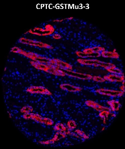 Click to enlarge image Imaging mass cytometry on normal kidney tissue core using CPTC-GSTMu3-3 metal-labeled antibody.  Data shows an overlay of the target protein signal (red) and DNA (blue). Dilution: 1:100 of 0.5mg/mL stock. Signal was also obtained in other normal tissues (testis, prostate, liver, colon, endometrium, appendix, pancreas, bone marrow, breast, kidney, lung, and placenta) and cancer tissues (breast, colon, prostate, lung, and ovarian).
