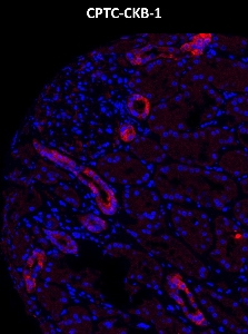Click to enlarge image Imaging mass cytometry on normal kidney tissue core using CPTC-CKB-1 metal-labeled antibody.  Data shows overlay of target protein signal (red) and DNA (blue). Dilution: 1:100 of 0.5mg/mL stock. Signal was also obtained in other normal tissues (testis, prostate, liver, colon, endometrium, appendix, pancreas, bone marrow, breast, kidney, lung, and placenta) and cancer tissues (breast, colon, prostate, lung, and ovarian).