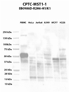 Click to enlarge image Western blot using CPTC-MST1-1 as primary antibody against PBMC (lane 2), HeLa (lane 3), Jurkat (lane 4), A549 (lane 5), MCF7 (lane 6), and NCI-H226 (lane 7) whole cell lysates.  Expected molecular weight - 80.3 kDa.  Molecular weight standards are also included (lane 1). PBMC is presumed positive.  All other cell lines are negative.