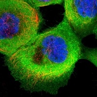 Click to enlarge image Results provided by the Human Protein Atlas (www.proteinatlas.org). The subcellular location is supported by literature. Immunofluorescent staining of human cell line A-431 shows localization to plasma membrane & cytosol. Human assay: A-431 fixed with PFA, dilution: 1:400
Human assay: U-2 OS fixed with PFA, dilution: 1:400
Human assay: U-251 MG fixed with PFA, dilution: 1:400