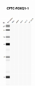 Click to enlarge image Automated Western Blot using CPTC-FOXQ1-1 as primary antibody against cell lysates A549, H226, HeLa, Jurkat and MCF7. Expected MW of 41.5 KDa. All cell lysates negative.  Molecular weight standards are also included (lane 1).