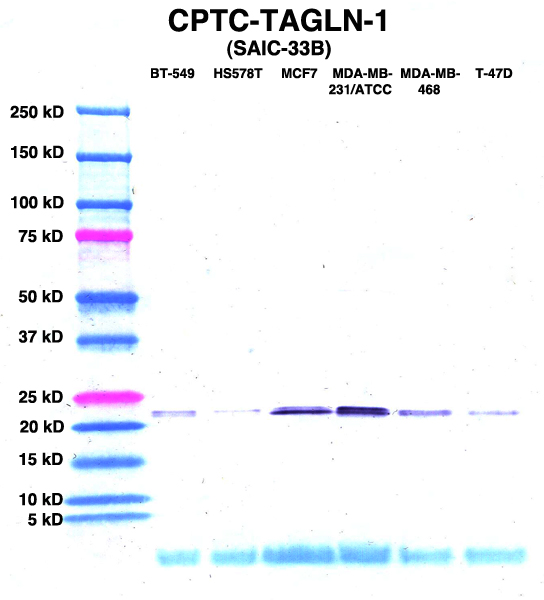 Click to enlarge image Western Blot using CPTC-TAGLN-1 as primary Ab against lysates from six breast cancer cell lines from the NCI60 cell line collection (lanes 2-7). Also included are molecular wt. standards (lane 1).