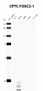 Click to enlarge image Automated Western Blot using CPTC-FOXC2-1 as primary antibody against cell lysates A549, H226, HeLa, Jurkat and MCF7. Expected MW of 53.7 KDa. All cell lysates negative.  Molecular weight standards are also included (lane 1).