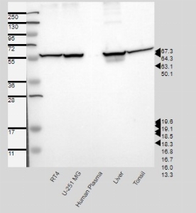 Click to enlarge image Results provided by the Human Protein Atlas (www.proteinatlas.org). Band of predicted size in kDa (+/-20%) with additional bands present. Analysis performed using a standard panel of samples. Antibody dilution: 1:250.