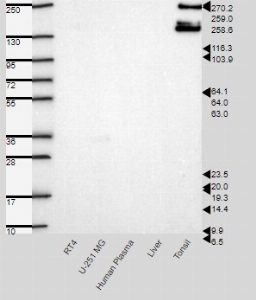 Click to enlarge image Results provided by the Human Protein Atlas (www.proteinatlas.org). Band of predicted size in kDa (+/-20%) with additional bands present. Analysis performed using a standard panel of samples. Antibody dilution: 1:500.