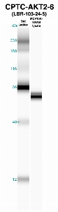 Click to enlarge image Western Blot using CPTC-AKT2-6 as primary Ab against MCF10A-KRas (lane 2). Also included are molecular wt. standards 