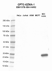 Click to enlarge image Western blot using CPTC-GZMA-1 as primary antibody against HeLa (lane 2), Jurkat (lane 3), A549 (lane 4), MCF7 (lane 5), and NCI-H226 (lane 6) whole cell lysates.  Expected molecular weight - 29.0 kDa and 27.1 kDa.  Molecular weight standards are also included (lane 1).
NCI-H226 is positive. All other cell lines are negative.
