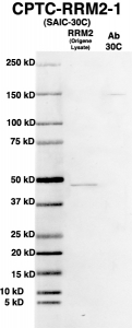 Click to enlarge image Western Blot using CPTC-RRM2-1 as primary Ab against HEK293T cell lysate containing RRM2 (from Origene) in lane 2. Also included are molecular wt. standards (lane 1) and the RRM2-1 Ab as the IgG control (lane 3).