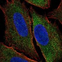 Click to enlarge image Results provided by the Human Protein Atlas (www.proteinatlas.org).

The subcellular location is supported by literature. Immunofluorescent staining of human cell line U2OS shows localization to cytosol.

Human assay: THP-1 fixed with PFA, dilution: 1:150
Human assay: U2OS fixed with PFA, dilution: 1:150