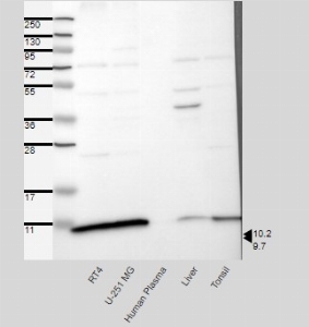 Click to enlarge image Results provided by the Human Protein Atlas (www.proteinatlas.org). Band of predicted size in kDa (+/-20%) with additional bands present. Analysis performed using a standard panel of samples. Antibody dilution: 1:250.