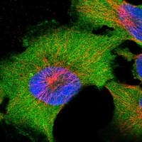 Click to enlarge image Results provided by the Human Protein Atlas (www.proteinatlas.org). The subcellular location is supported by literature. Immunofluorescent staining of human cell line U-251 MG shows localization to plasma membrane & cytosol. Human assay: A-431 fixed with PFA, dilution: 1:400
Human assay: U-2 OS fixed with PFA, dilution: 1:400
Human assay: U-251 MG fixed with PFA, dilution: 1:400