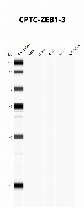 Click to enlarge image Automated Western Blot using CPTC-ZEB1-3 as primary antibody against cell lysates A549, H226, HeLa, Jurkat and MCF7. Expected MW of 124 KDa. All cell lysates negative.  Molecular weight standards are also included (lane 1).