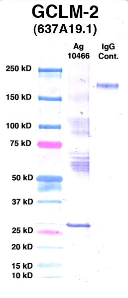Click to enlarge image Western Blot Using CPTC-GCLM-2 as primary Ab against GCLM (Ag 10466)(Lane 2). Also included are Molecular Weight markers (Lane 1) and mouse IgG positive control (Lane 3).