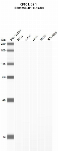 Click to enlarge image Automated western blot using CPTC-LIG1-1 as primary antibody against HeLa (lane 2), Jurkat (lane 3), A549 (lane 4), MCF7 (lane 5), and NCI-H226 (lane 6) whole cell lysates.  Expected molecular weight - 101.7 kDa, 88.5 kDa, and 98.2 kDa.  Molecular weight standards are also included (lane 1).