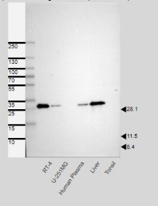 Click to enlarge image Results provided by the Human Protein Atlas (www.proteinatlas.org). Single band corresponding to the predicted size in kDa (+/-20%).
Analysis performed using a standard panel of samples. Antibody Dilution 1:500