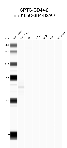 Click to enlarge image Automated western blot using CPTC-CD44-2 as primary antibody against buffy coat (lane 2), HeLa (lane 3), Jurkat (lane 4), A549 (lane 5), MCF7 (lane 6), and H226 (lane 7) whole cell lysates. . Molecular weight standards are also included (lane 1). All tested cell lines are negative.
