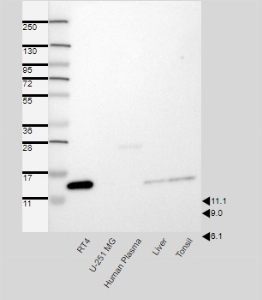 Click to enlarge image Results provided by the Human Protein Atlas (www.proteinatlas.org). Band of predicted size in kDa (+/-20%) with additional bands present. Analysis performed using a standard panel of samples. Antibody dilution: 1:500.
