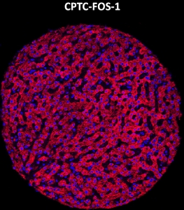 Click to enlarge image Imaging mass cytometry on normal liver tissue core using CPTC-FOS-1 metal-labeled antibody.  Data shows an overlay of the target protein signal (red) and DNA (blue). Dilution: 1:100 of 0.5mg/mL stock. Signal was also obtained in other normal tissues (liver, bone marrow, spleen, placenta, prostate, colon, pancreas, breast, lung, testis, endometrium, appendix, and kidney) and cancer tissues (colon, breast, ovarian, lung, and prostate).