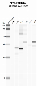 Click to enlarge image Automated western blot using CPTC-PSMB10-1 as primary antibody against PBMC (lane 2), HeLa (lane 3), Jurkat (lane 4), A549 (lane 5), MCF7 (lane 6), and NCI-H226 (lane 7) whole cell lysates.  Expected molecular weight - 28.9 kDa.  Molecular weight standards are also included (lane 1).