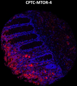 Click to enlarge image Imaging mass cytometry on normal colon tissue core using CPTC-MTOR-4 metal-labeled antibody.  Data shows an overlay of the target protein signal (red) and DNA (blue). Dilution: 1:100 of 0.5mg/mL stock. Signal was also obtained in other normal tissues (liver, bone marrow, spleen, prostate, colon, breast, lung, testis, and endometrium) and cancer tissues (breast, prostate, colon, ovarian, and lung).