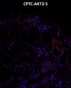 Click to enlarge image Imaging mass cytometry on normal pancreas tissue core using CPTC-AKT2-5 metal-labeled antibody.  Data shows overlay of target protein signal (red) and DNA (blue). Dilution: 1:100 of 0.5mg/mL stock. Signal was also obtained in other normal tissues (testis, colon, pancreas, bone marrow, breast, kidney, and placenta) and cancer tissues (breast, colon, prostate, and lung).