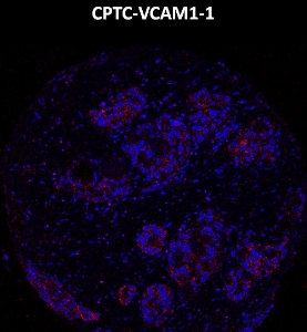 Click to enlarge image Imaging mass cytometry on colon cancer tissue core using CPTC-VCAM1-1 metal-labeled antibody.  Data shows overlay of target protein signal (red) and DNA (blue). Dilution: 1:100 of 0.5mg/mL stock. Signal was also obtained in other normal tissue (colon) and cancer tissue (lung).