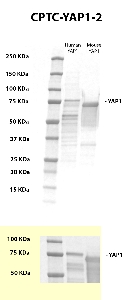 Click to enlarge image Western blot using CPTC-YAP1-2 as primary antibody against recombinant human and mouse YAP1 protein (MYC-tagged) in over-expressed lysates. The antibody is able to detect the target protein in both species. The same MYC-tagged proteins were also tested with an anti-MYC antibody for MW validation.