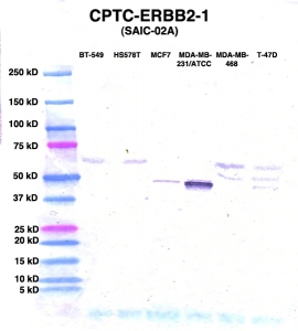Click to enlarge image Western Blot using CPTC-ERBB2-1 as primary Ab against lysates from six breast cancer cell lines from the NCI60 cell line collection (lanes 2-7). Also included are molecular wt. standards (lane 1).