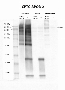 Click to enlarge image IP-WB performed with CPTC-APOB-2 antibody as capture antibody. Eluates were screened in WB using antibody CPTC-APOB-3 as detection antibody. CPTC-APOB-2 was able to pull down the native protein purified from human plasma, in HepG2 lysate and the protein in human plasma. APOB MW is 515 KDa.