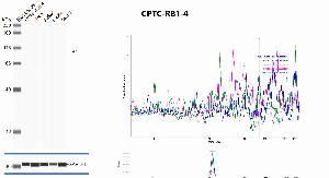 Click to enlarge image Automated western blot using CPTC-RB1-4 as primary antibody against whole lysates of cell lines CCRF-CEM, HeLa, Jurkat, K-562 and MCF7. Protein molecular weight is about 106 KDa. The antibody cannot recognize the target in any of the tested lysates. Loading controls were run with anti-GAPDH antibody.