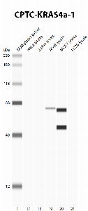 Click to enlarge image Autometed Western Blot using CPTC-KRas4a-1as primary antibody against cell lysates of HeLa, Jurkat, A549, MCF7 and H226. Presumed positive for MCF7. Expected MW is ~21KDa.