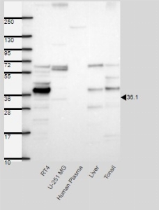 Click to enlarge image Results provided by the Human Protein Atlas (www.proteinatlas.org). Band of predicted size in kDa (+/-20%) with additional bands present. Analysis performed using a standard panel of samples. Antibody dilution: 1:500