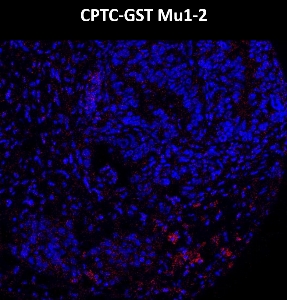 Click to enlarge image Imaging mass cytometry on ovarian cancer tissue core using CPTC-GSTMu1-2 metal-labeled antibody.  Data shows an overlay of the target protein signal (red) and DNA (blue). Dilution: 1:100 of 0.5mg/mL stock. Signal was also obtained in other normal tissue (liver) and cancer tissues (lung and ovarian).