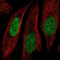 Click to enlarge image Results provided by the Human Protein Atlas (www.proteinatlas.org). The subcellular location is supported by literature. Immunofluorescent staining of human cell line HeLa shows localization to nucleoplasm. 
Human assay: HeLa fixed with PFA, dilution: 1:2000
Human assay: MCF7 fixed with PFA, dilution: 1:2000
Human assay: U-2 OS fixed with PFA, dilution: 1:2000