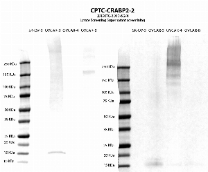 Click to enlarge image Western blot using CPTC-CRABP2-2 as primary antibody against cell lysates and supernatants of cell lines OVCAR-3, OVCAR-4, OVAR-8 and SK-OV-3. Expected molecular weight is 15.6 KDa.  Positive for OVCAR-3 cell lysates. Molecular weight standards are also included.