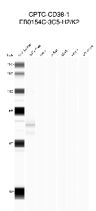 点击放大图像使用CPTC-CD38-1作为主要抗体的自动免疫印迹法，以对抗棕黄色大衣（2道）、HeLa（3道）、Jurkat（4道）、A549（5道）、MCF7（6道）和H226（7道）全细胞裂解物。预期分子量-34.3 kDa和13.8 kDa。还包括分子量标准（车道1）。软毛被推定为阳性。所有其他细胞系均为阴性。
