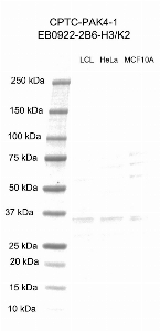 Click to enlarge image Western Blot using CPTC-PAK4-1 as primary antibody against cell lysates LCL57 (lane 2), HeLa (lane 3) and MCF10A (lane 4). Also included are molecular weight standards (lane 1).