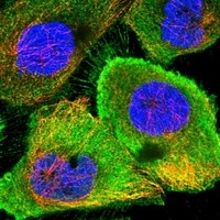 Click to enlarge image Results provided by the Human Protein Atlas (www.proteinatlas.org). The subcellular location is supported by literature. Immunofluorescent staining of human cell line A-431 shows localization to plasma membrane & cytosol. Human assay: A-431 fixed with PFA, dilution: 1:500
Human assay: U-2 OS fixed with PFA, dilution: 1:500
Human assay: U-251 MG fixed with PFA, dilution: 1:500